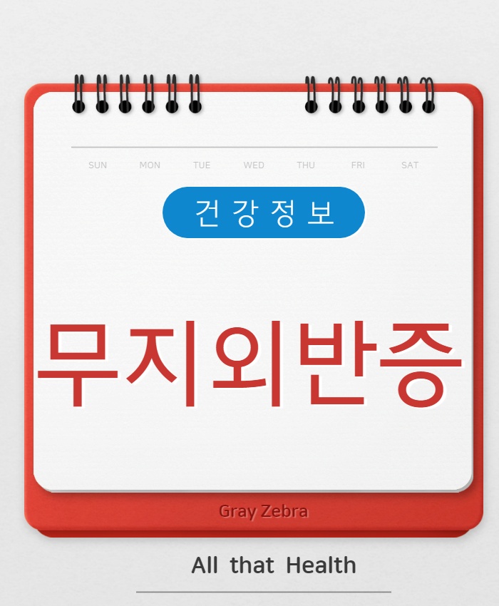 무지외반증