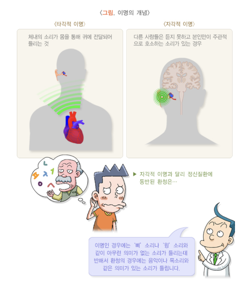 이명의 개념