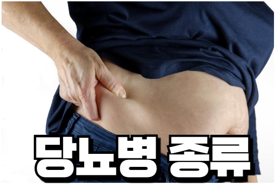 당뇨병 종류