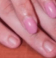 손톱이 잘 부러지는 이유와 갈라지는 이유