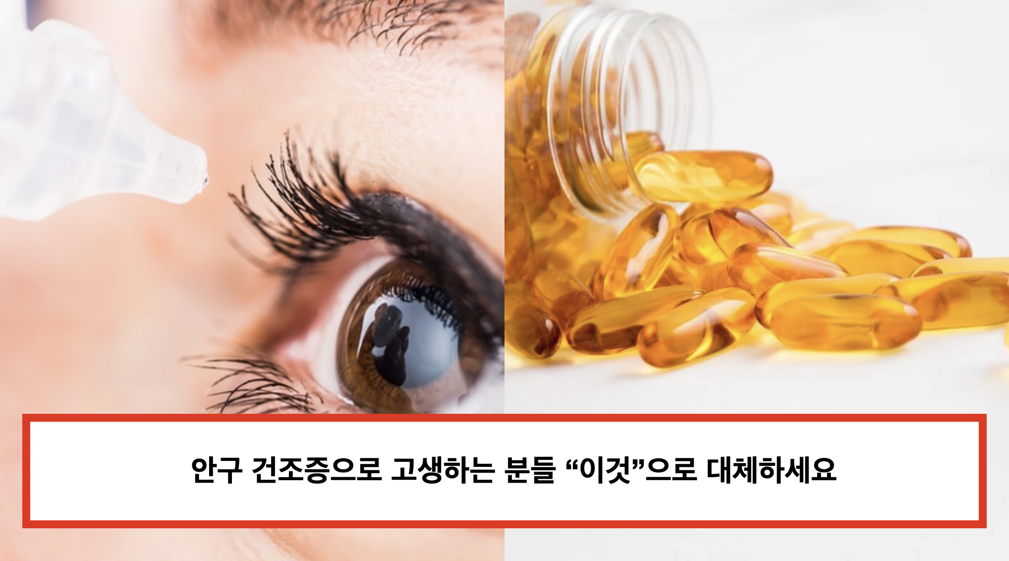 안구건조증