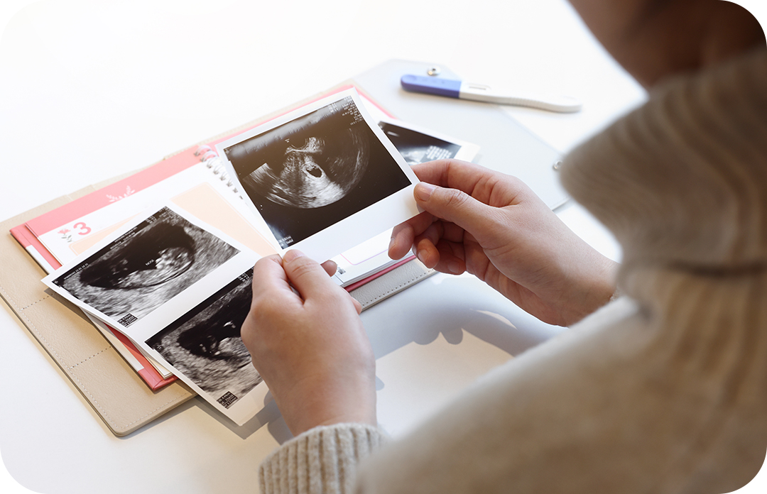 임신 수첩에 있는 태아 사진을 보고있는 사람