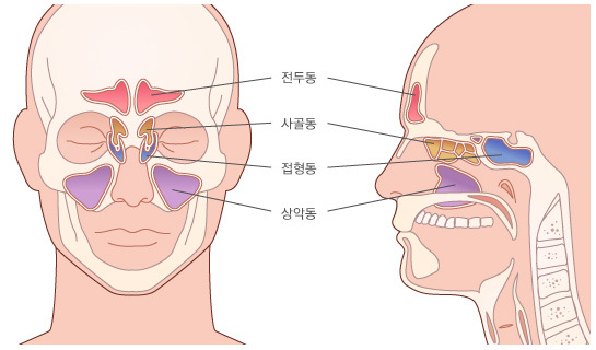 부비동암-비강암-증상-원인-진단-(+비염과-차이점-)