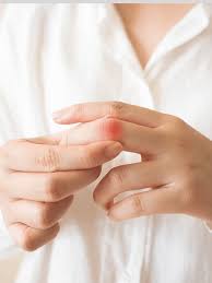 손가락 관절염 초기증상