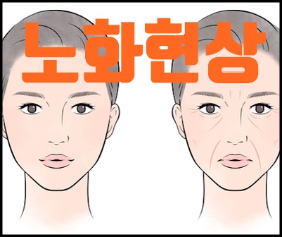 노화원인