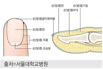 손톱구조