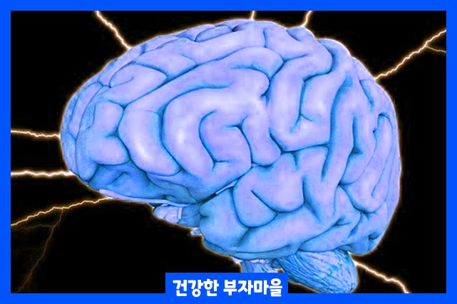 뇌졸중 전조증상