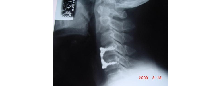 안산 상록구 정형외과