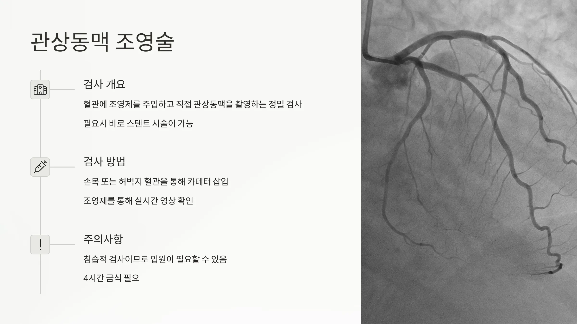관상동맥 조영술에 관한 설명