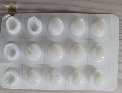 남성 탈모 대부분을 차지하는 유형 중 M자 탈모의 원인과 두타스테리드(아보다트)치료와 부작용 그리고 주의 사항 및 5년 간 실제 복용 후기