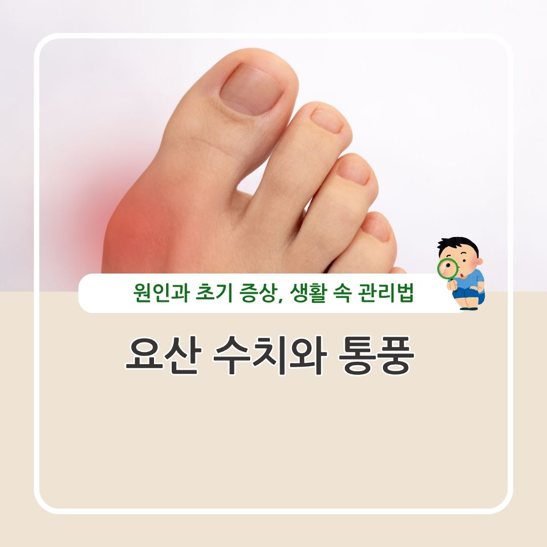 요산 수치와 통풍 원인과 초기 증상 생활 관리법 정리
