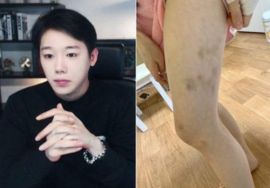 '궁금한 이야기Y에서 BJ 백승찬의 폭력, 도박, 마약 범죄를 일으키고 돌연 잠적한 이야기가 소개되었다.