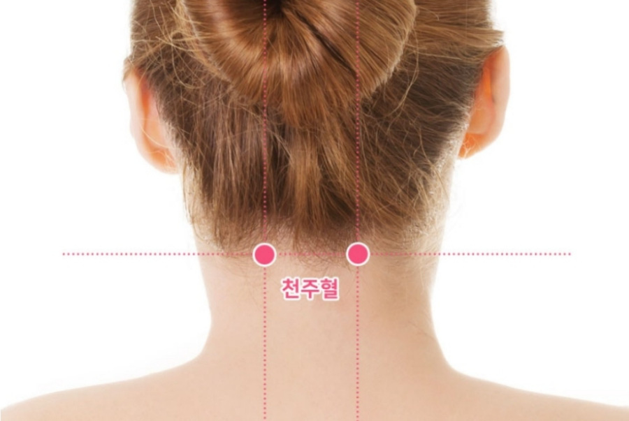 인체의 365혈 중에서 목 뒷쪽에 위치를 하고 있는 천주혈의 위치를 표시를 한 사진