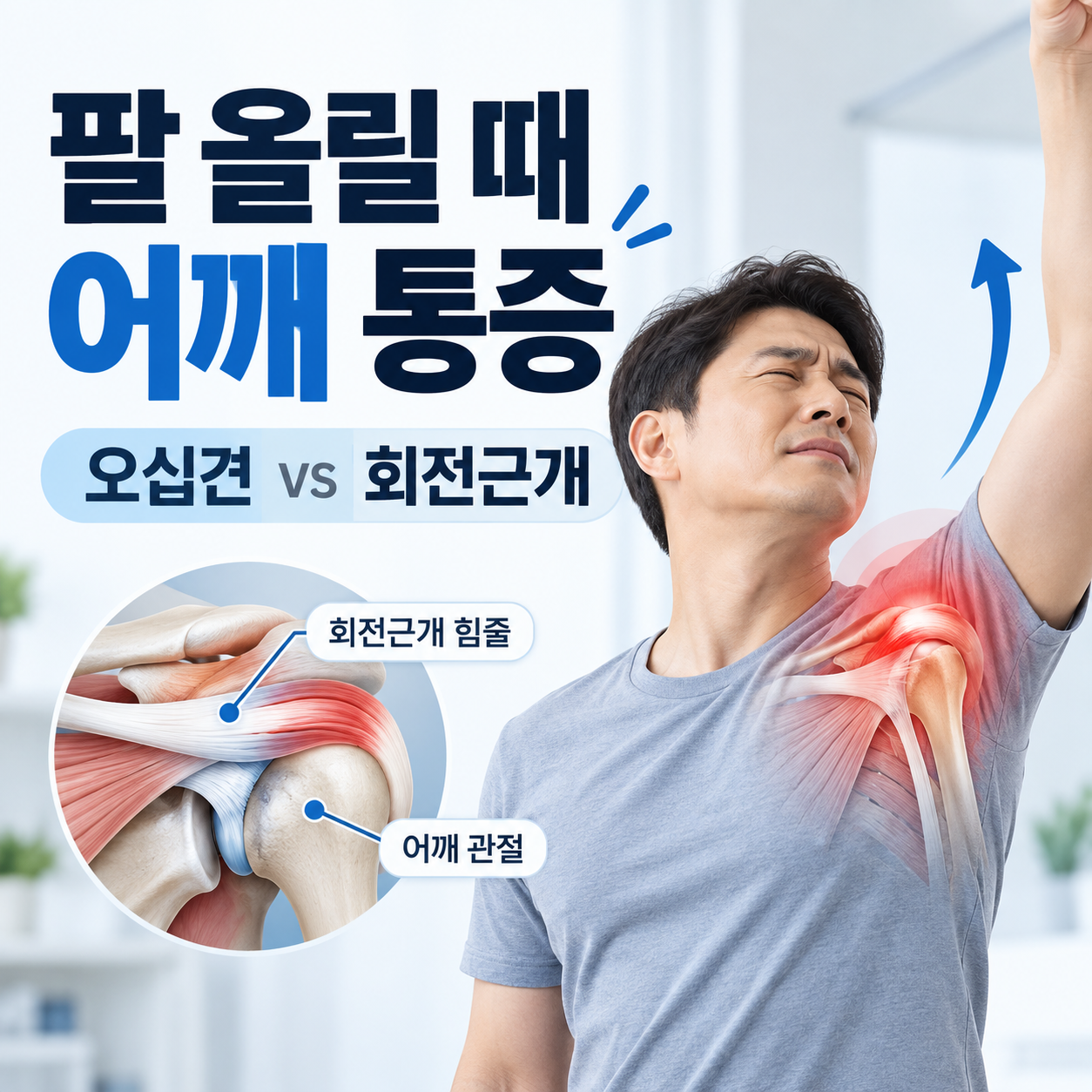 팔 올릴 때 어깨 통증
