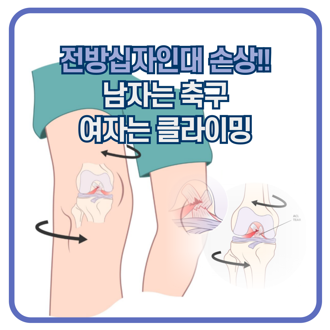 남자는 축구, 여자는 클라이밍 부상!! 전방십자인대 손상, 수술 후 재활