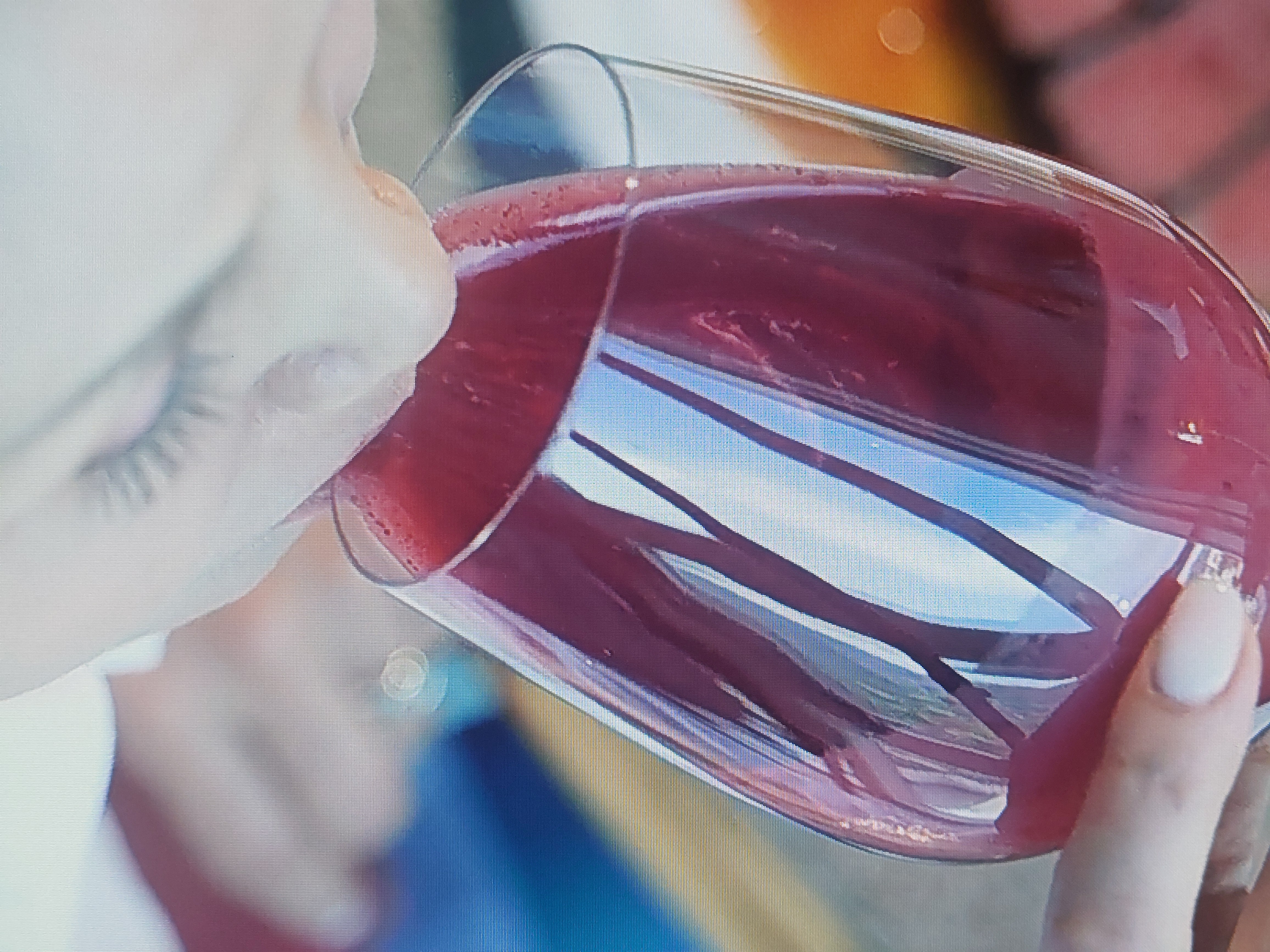 링곤베리 퓨레 쥬스 고르는 법