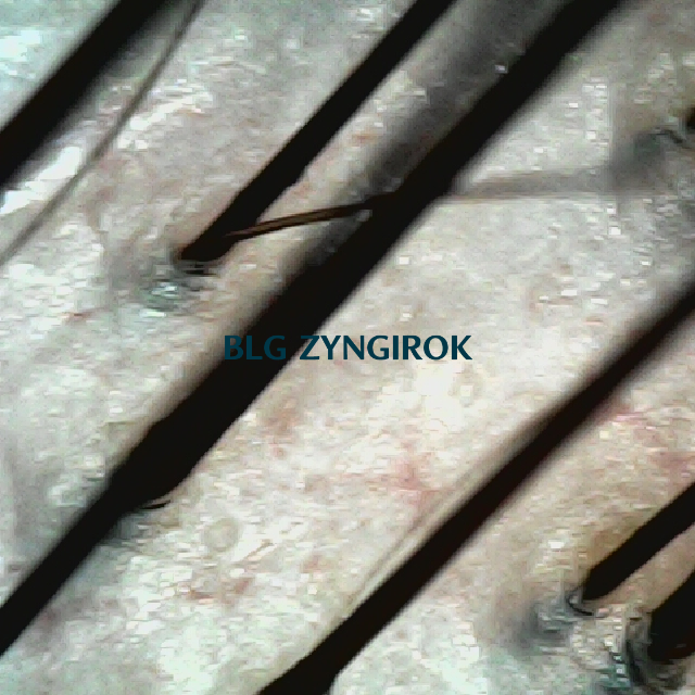 피나모아 복용 11주차 두피사진 - 뒷머리 모습이다.