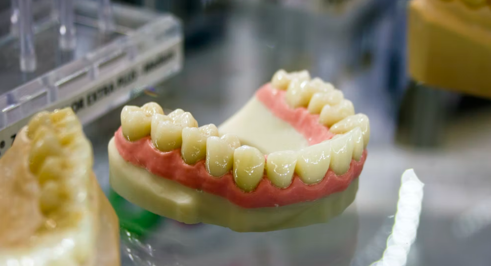 만성 치주질환 원인 및 증상 관리방법 알아보아요