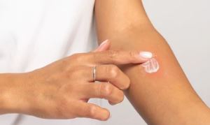 멍연고(멍크림) 바르기(멍 빨리 빼는법)