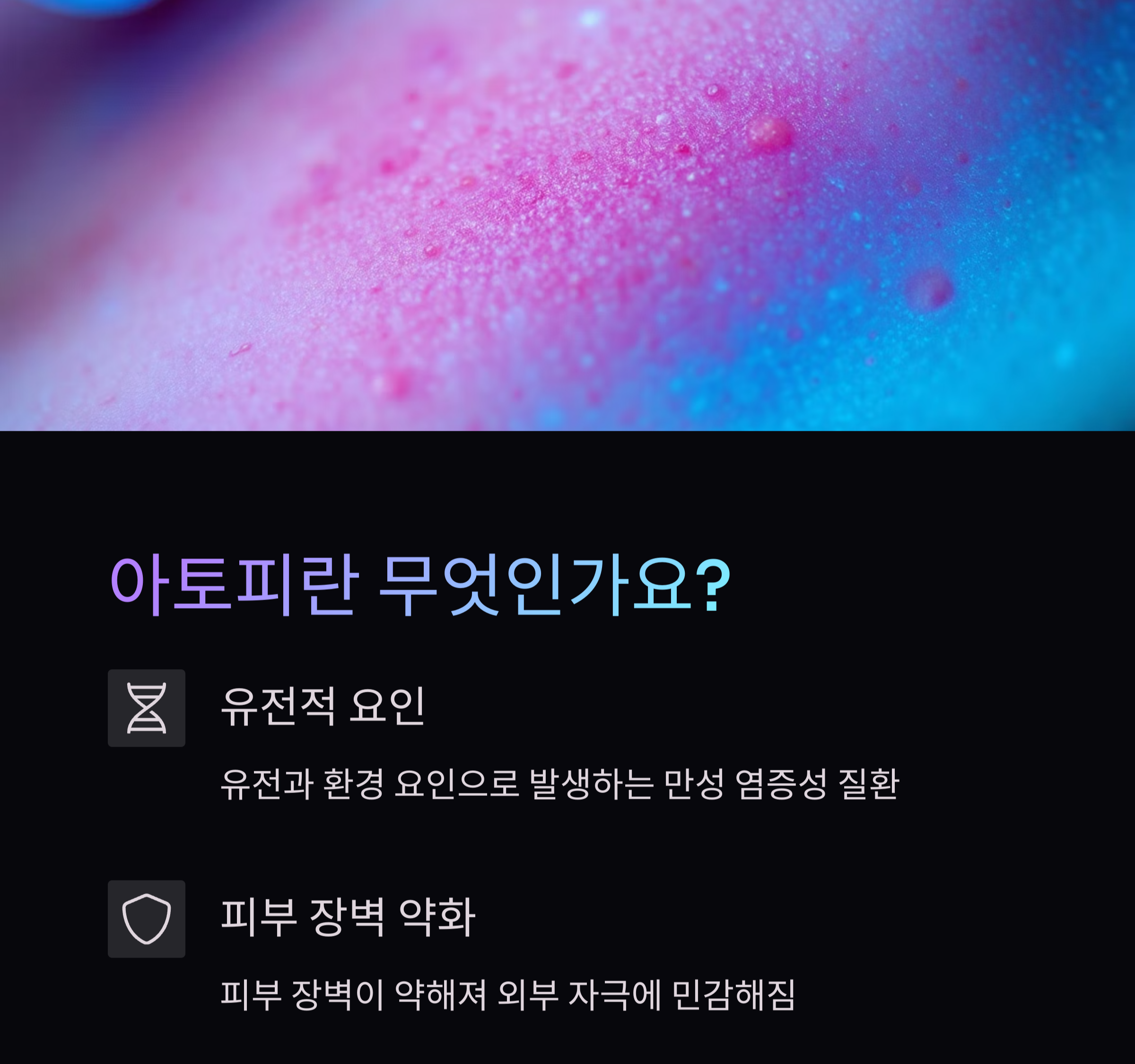 아토피에 좋은 음식 효능과 레시피 관련사진