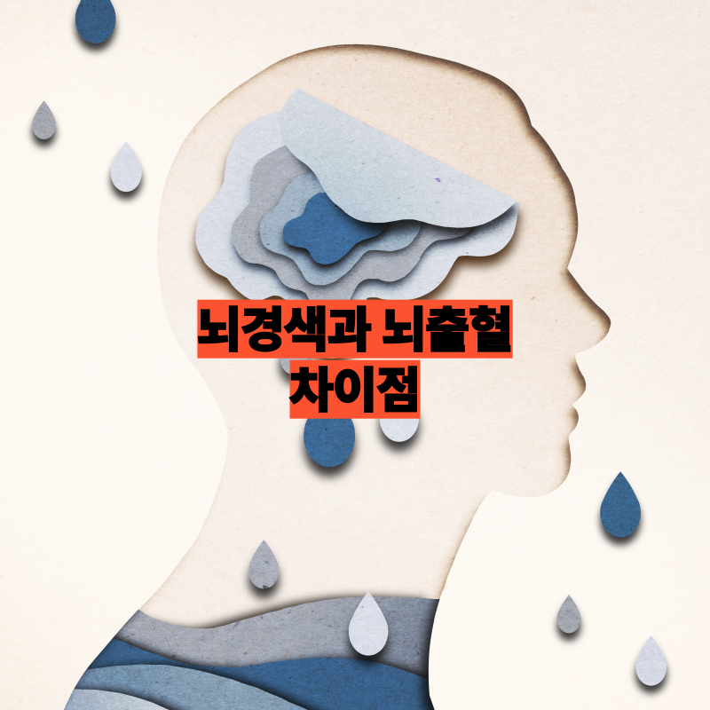 뇌경색과 뇌출혈의 차이점, 제대로 알고 대비하기
