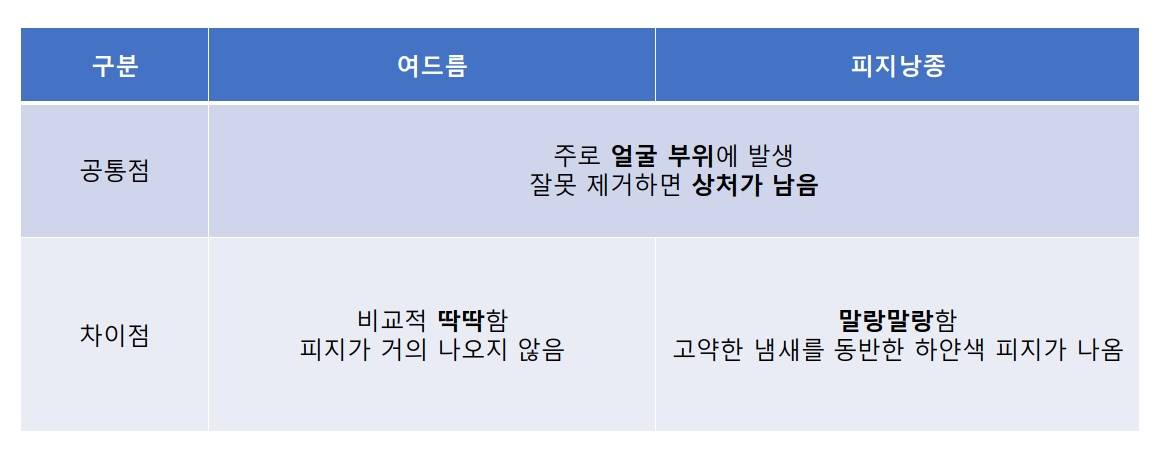 피지낭농과 여드름의 공통점과 차이점