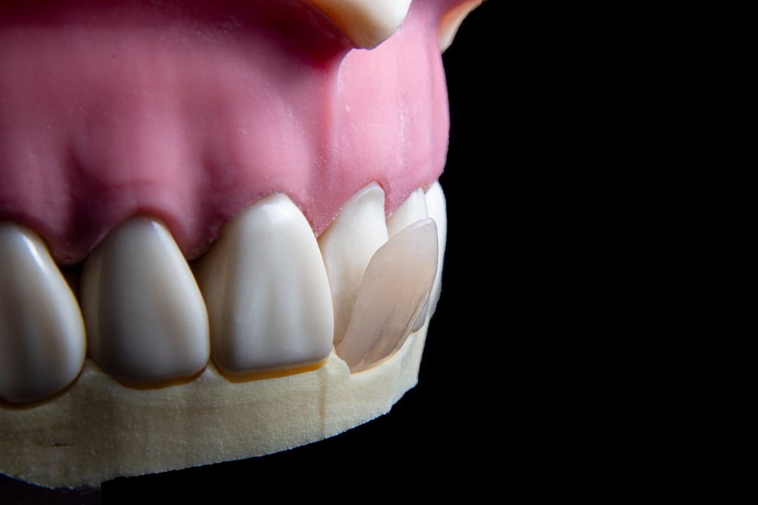 Dental prosthetics