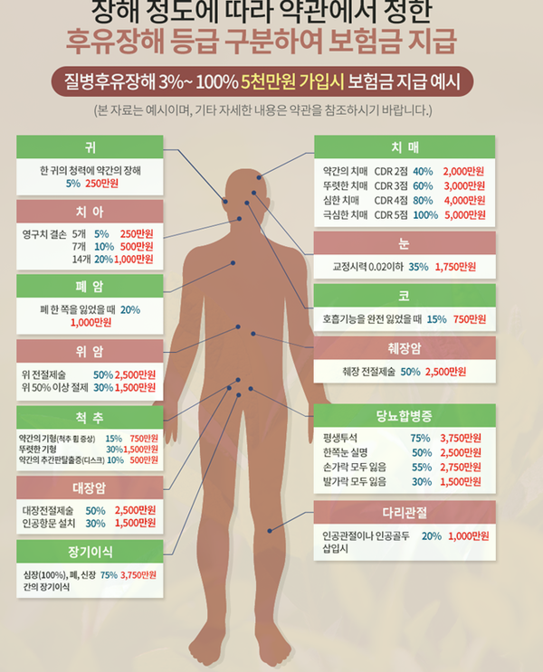 후유장해