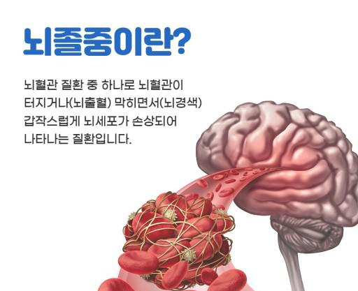 뇌졸중 전조증상과 체크리스트 및 예방과 치료