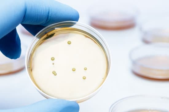 락토바실러스(Lactobacillus)에 대한 이해