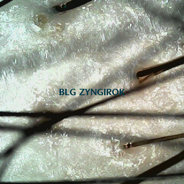 탈모 극복 프로젝트 - 정수리와 이마 사이 두피 모습이다.