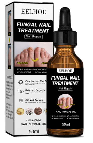 발톱무좀약 추천