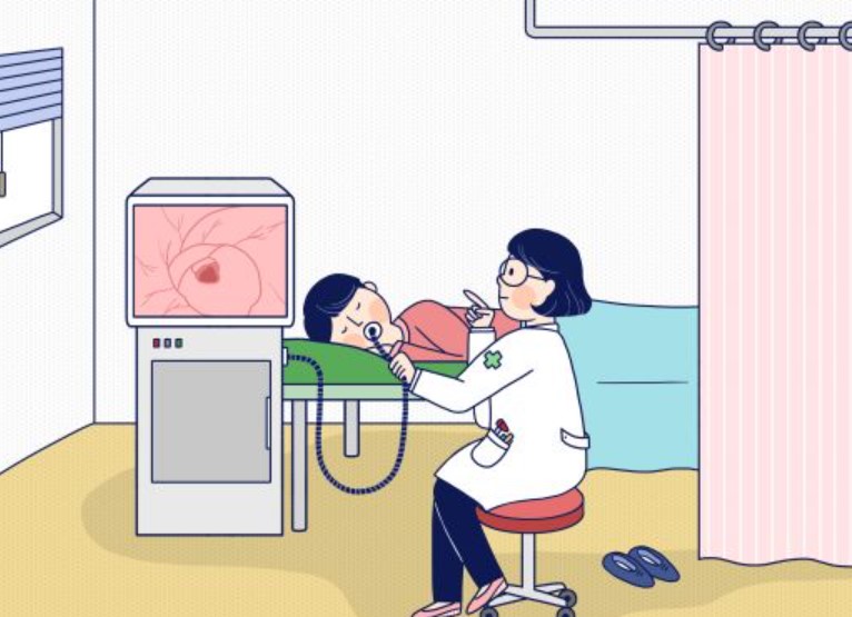 위내시경 검사 모습