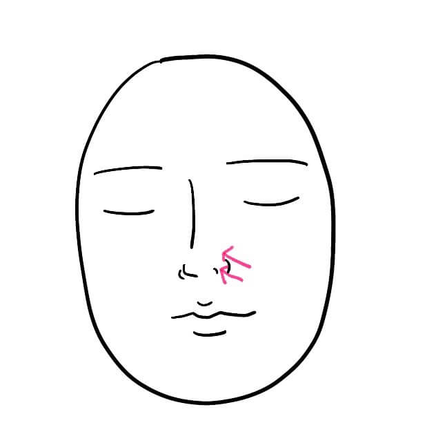 코옆각질-코옆들뜸