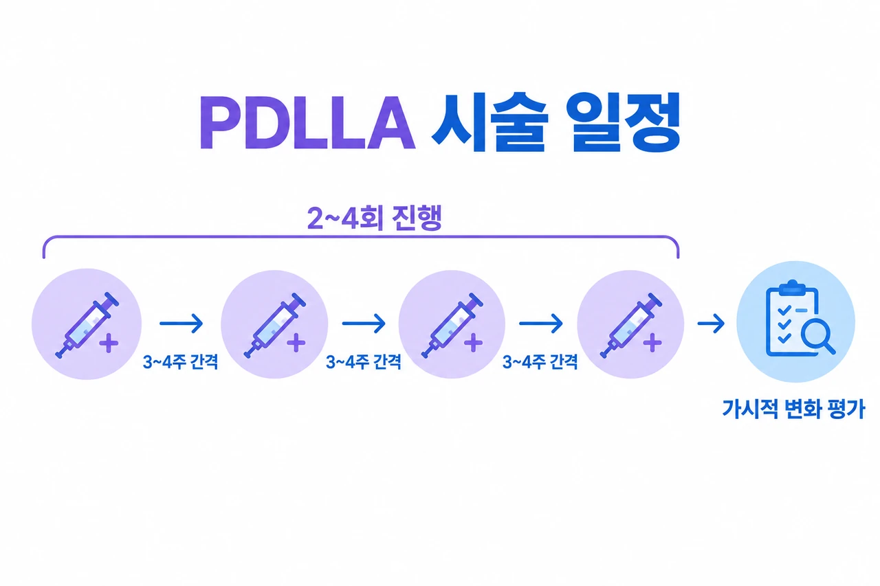 PDLLA timeline shows 3~4주 간격으로 2~4회 진행 후 가시적 변화 평가 for 피부 유형별 스킨부스터 성분 용량 2026.