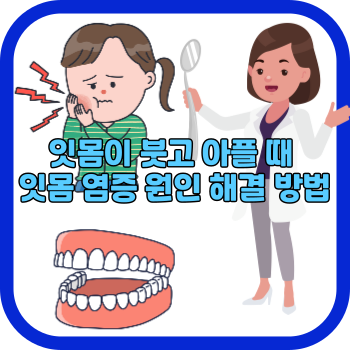 잇몸이 붓고 아플 때 잇몸 염증 원인 해결 방법