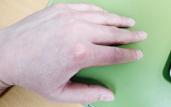 손등을-보이며-책상에-올려진-손