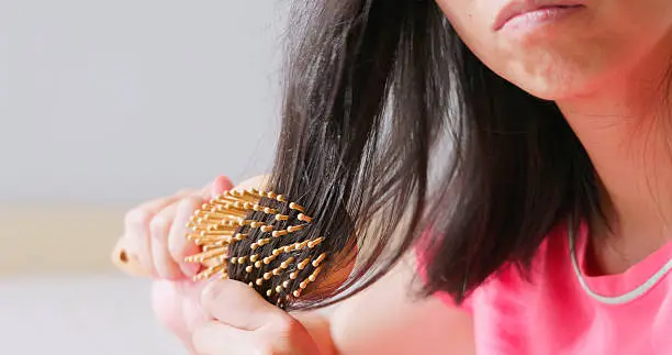 탈모 예방 방법