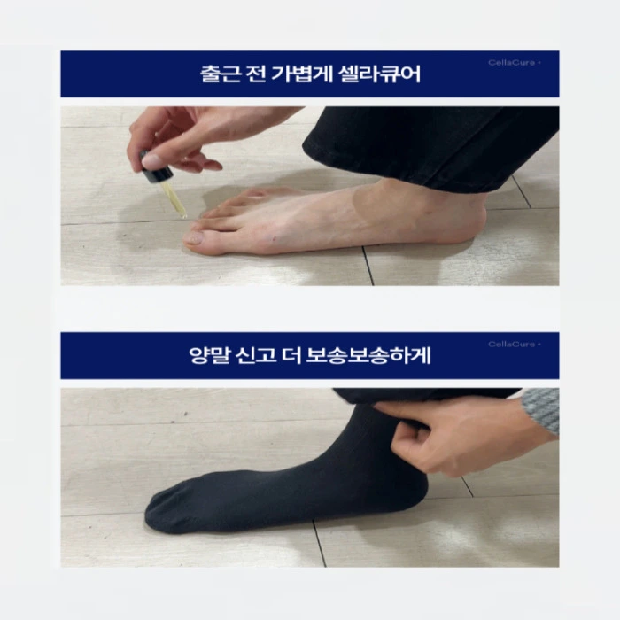 셀라큐어 문제성 발톱 솔루션 내돈내산 후기 부작용 성분 효능 사용법 가격