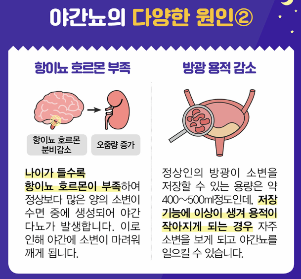야간뇨의 다양한 원인 이미지