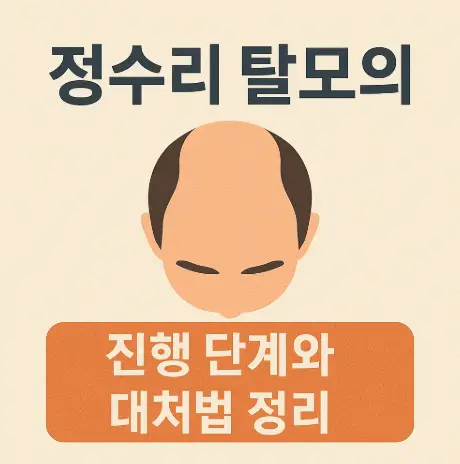 정수리 탈모의 진행 단계와 대처법 정리