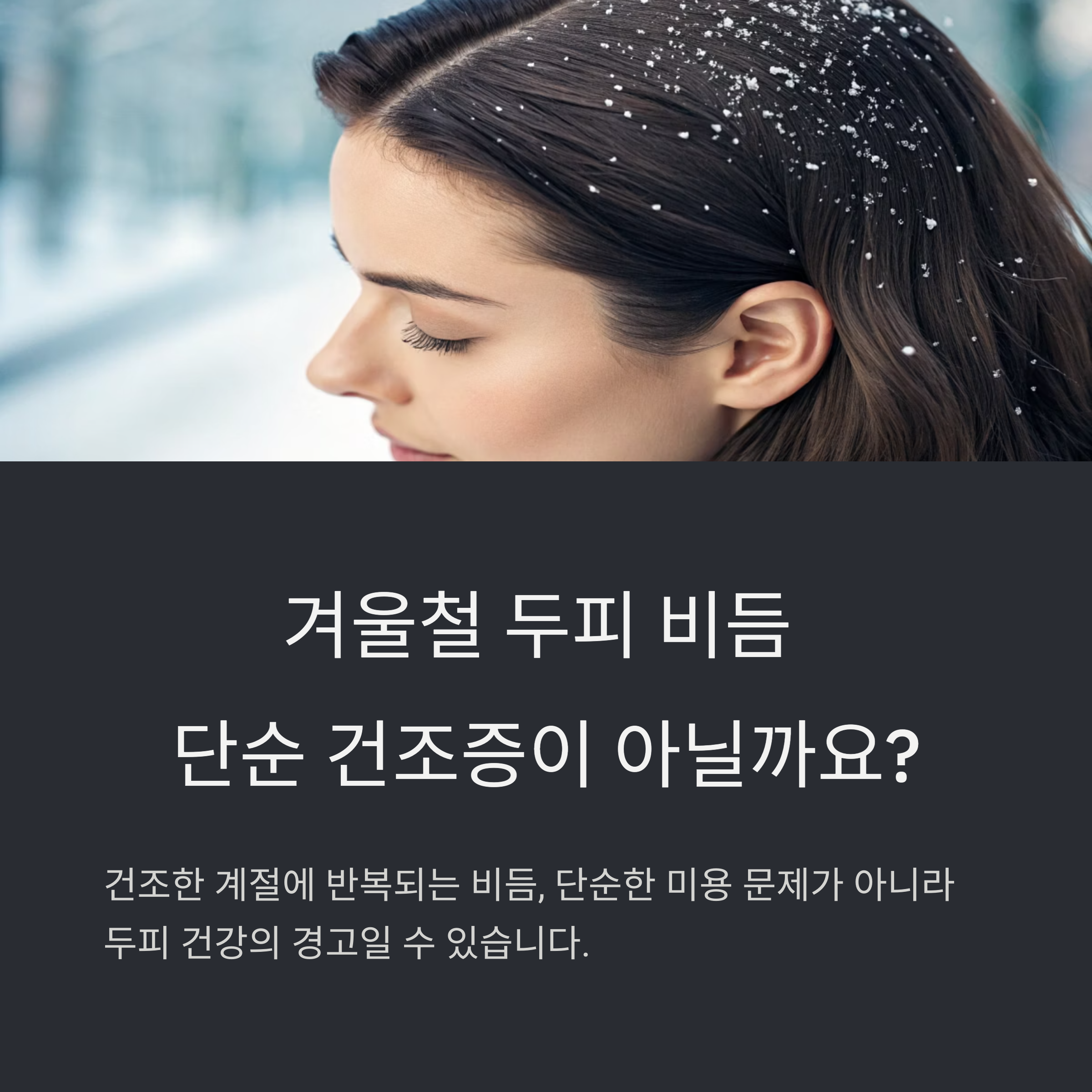 비듬
