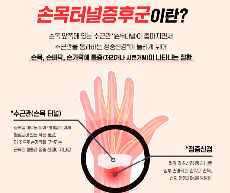 손목 통증 완화 운동