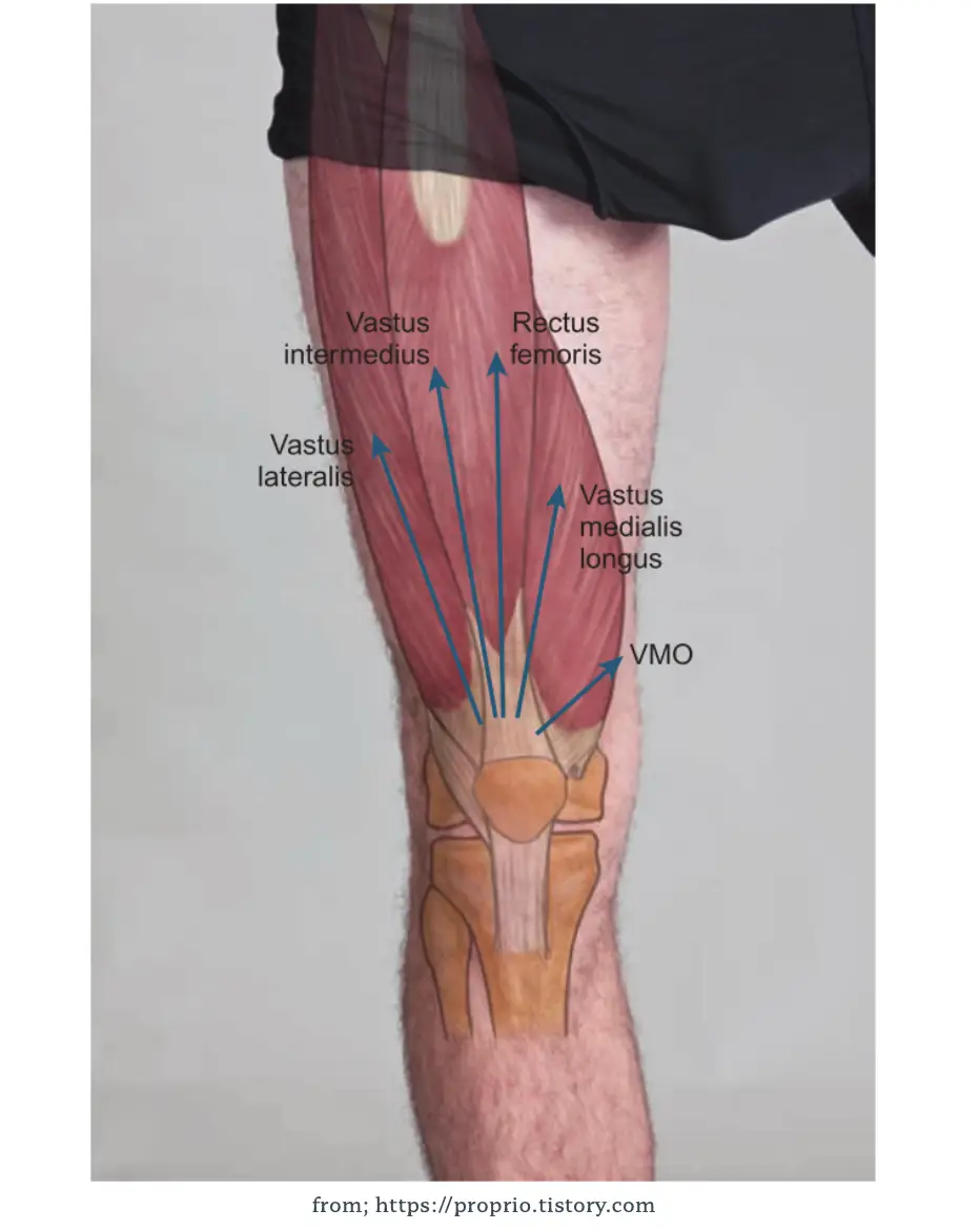 슬개대퇴통증증후군: 원인, 증상 및 효과적인 관리 방법