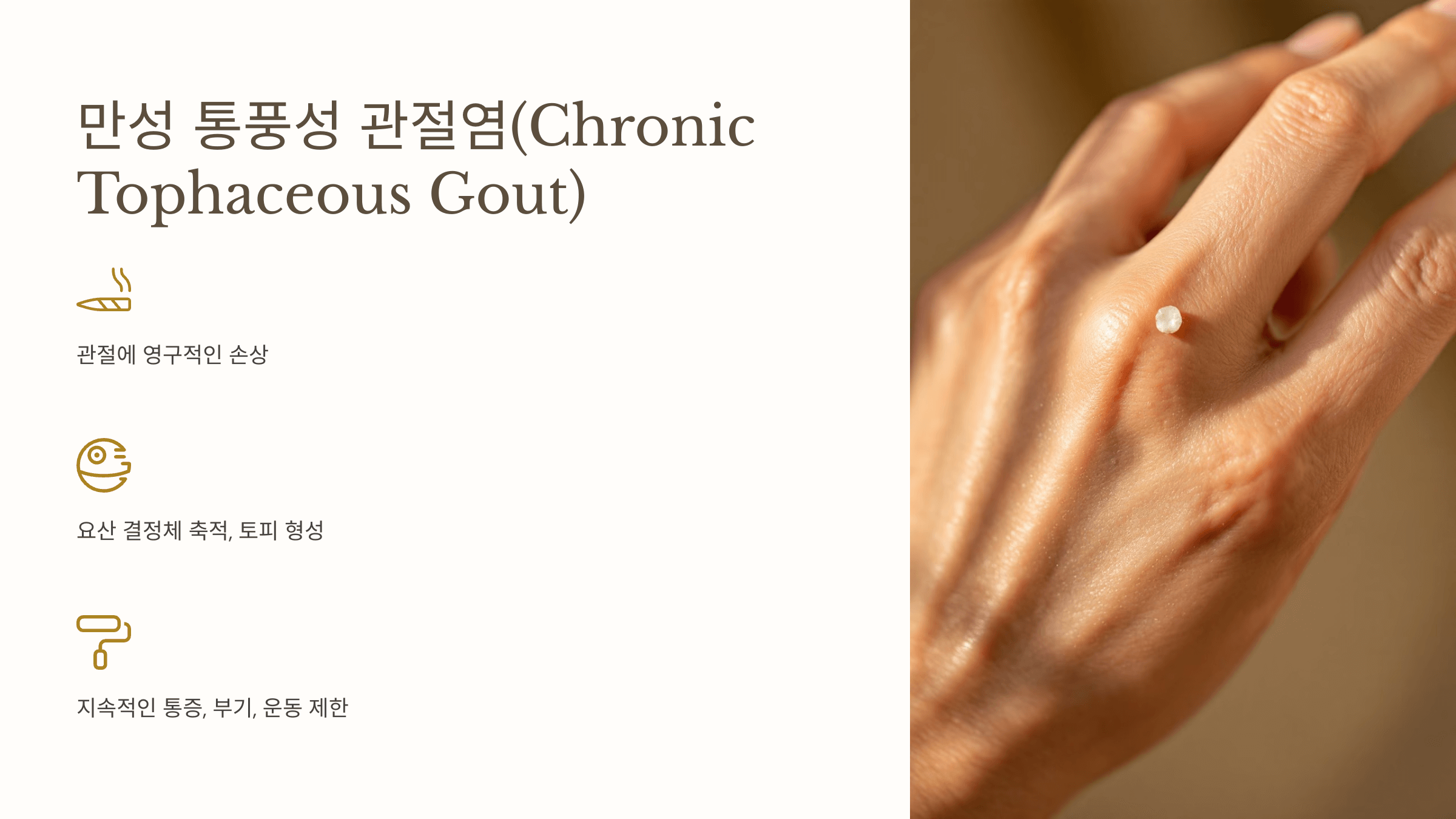 통풍과 관련된 사진입니다.