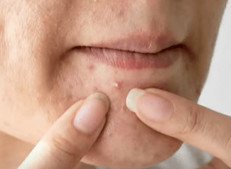 잘못된 피부 관리