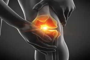 무릎-인공관절수술-회복기간