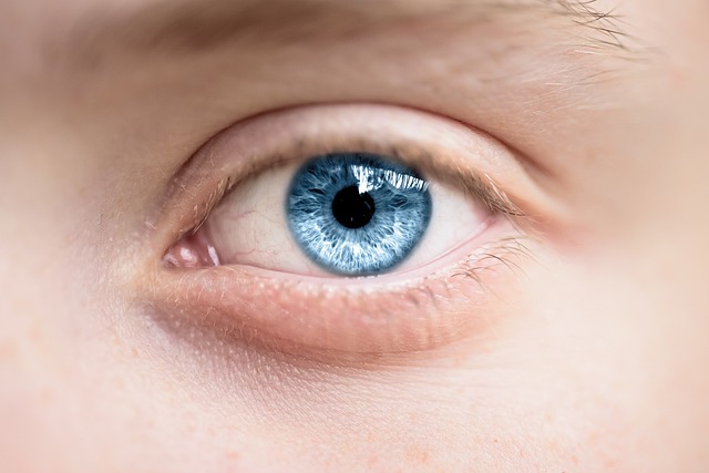 안구건조증 안구건조증 증상과 안구건조증 치료방법