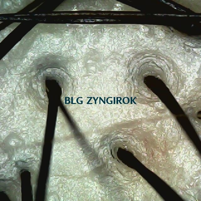 탈모 극복 프로젝트 - 정수리 두피 모습이다.