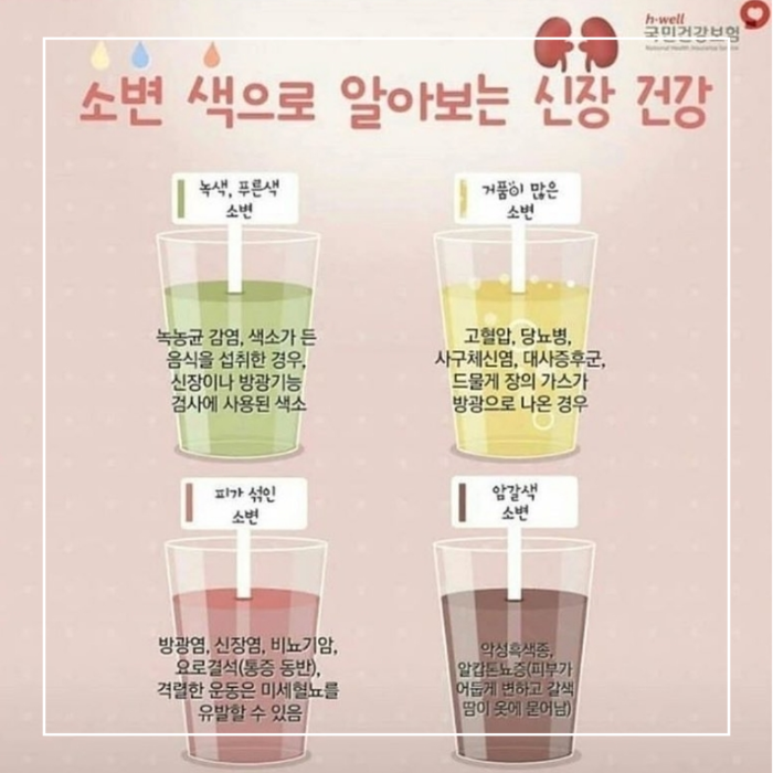 소변색으로 알아보는 신장 건강